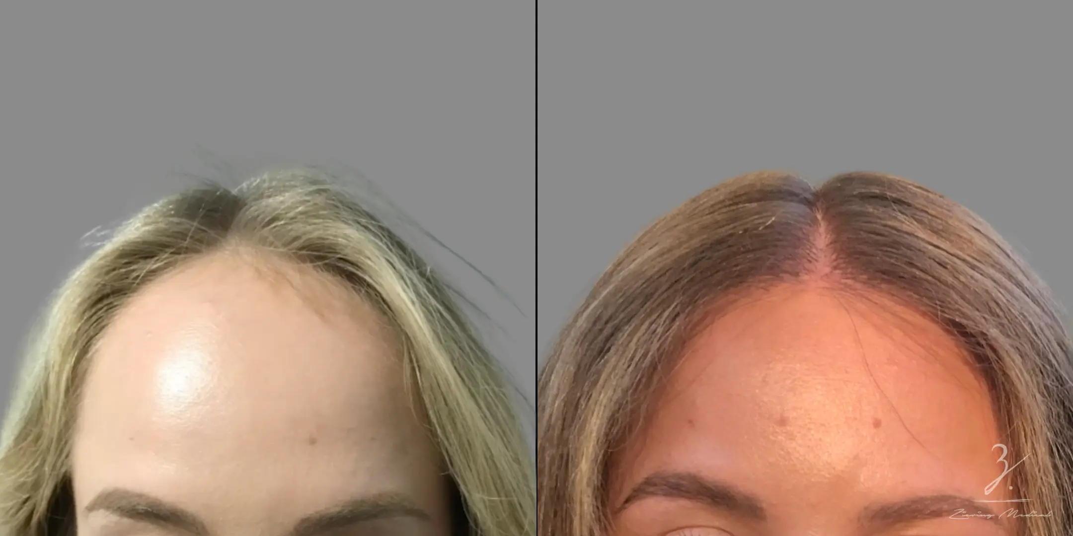 New York Hair Systems Tailored for You